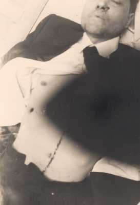  Le corps meurtri
d'Antoine ESPOSITO 
