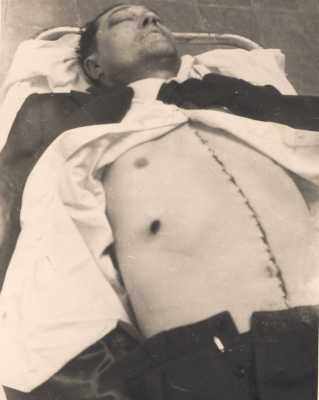  Le corps meurtri
d'Antoine ESPOSITO 
